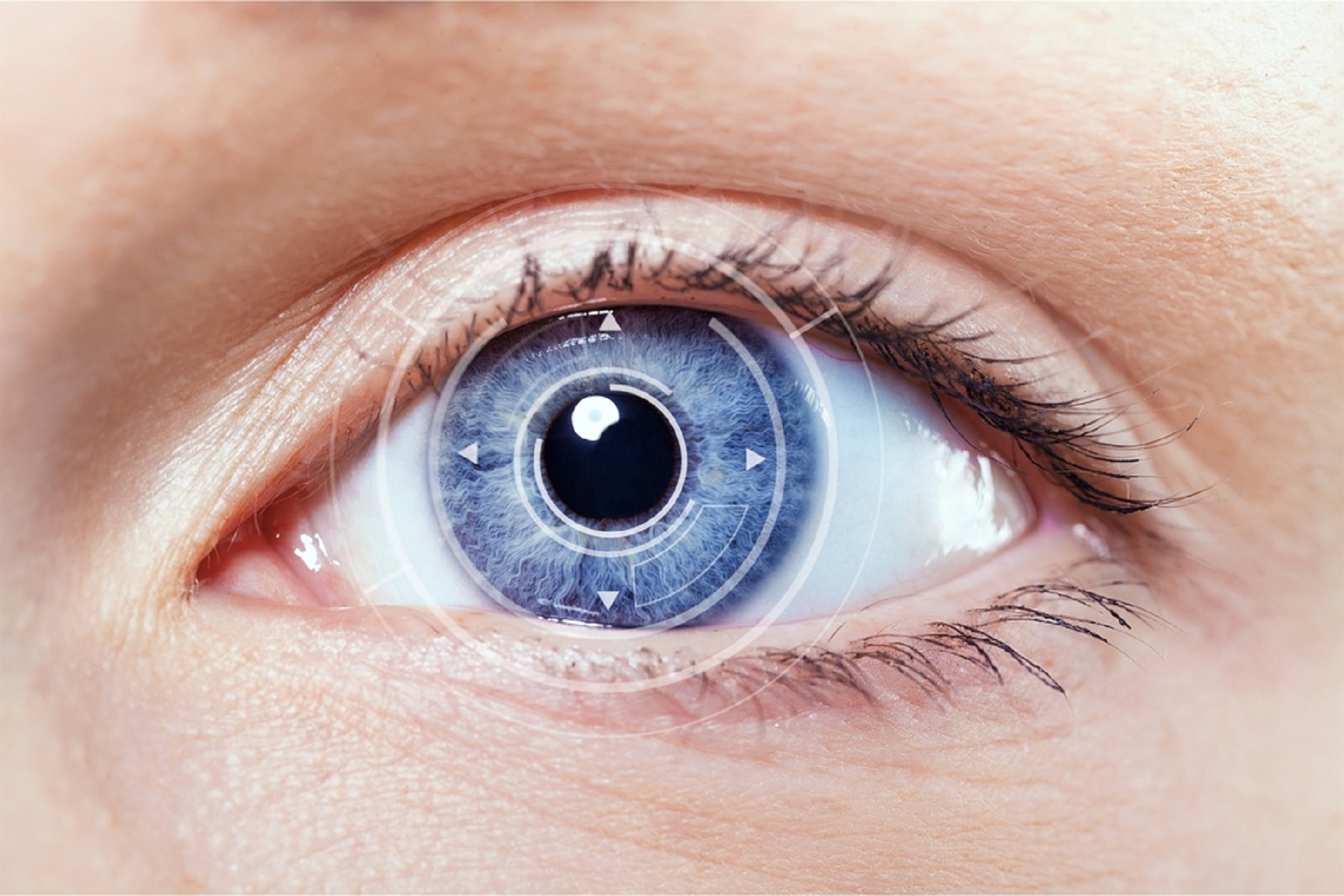 Μάτια Καταρράκτης: Πώς και γιατί εμφανίζεται – Συμπτώματα και Αντιμετώπιση