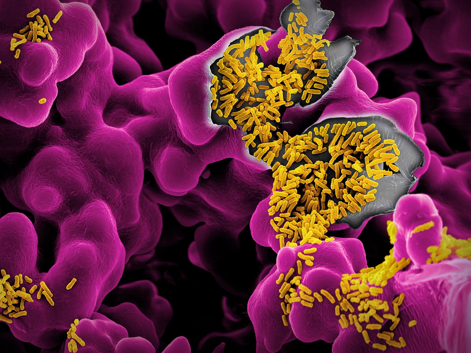Αίμα μικρόβιο έντερο: Γενετική παραλλαγή στον ανθρώπινο μεταβολισμό