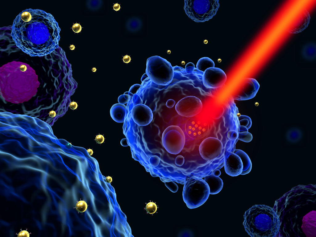 Καρκίνος πάγκρεας θεραπεία: Καινοτόμα τεχνολογία με νανοσωματίδια