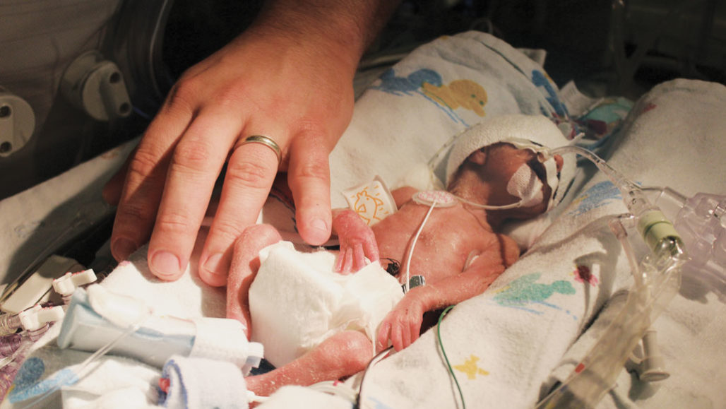 Πρόωρη γέννηση: Μπορεί να αποφευχθεί με την αντιμετώπιση του εμβρύου ως ασθενούς