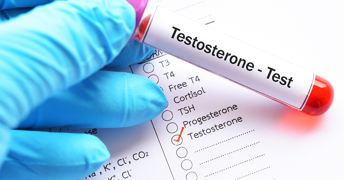 Τεστοστερόνη Τιμή: Τα συμπτώματα χαμηλής αντρικής ορμόνης