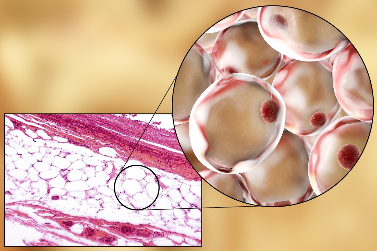 Λιποκύτταρα θερμίδες κύτταρα: Ανακαλύφθηκαν δύο νέοι μηχανισμοί