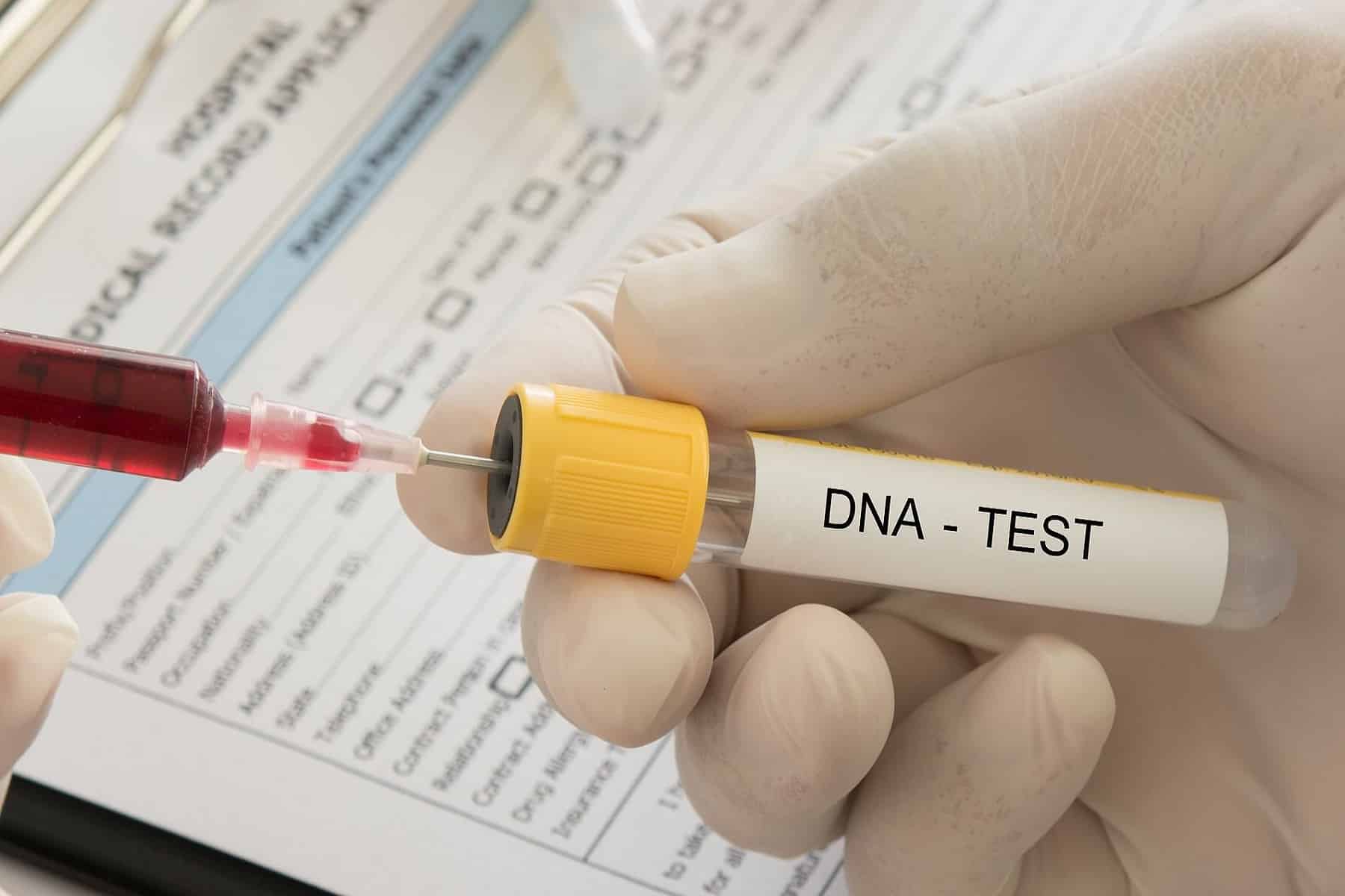 ΕΣΥ Μ. Βρετανία: Έλεγχοι dna για εξατομικευμένες θεραπείες