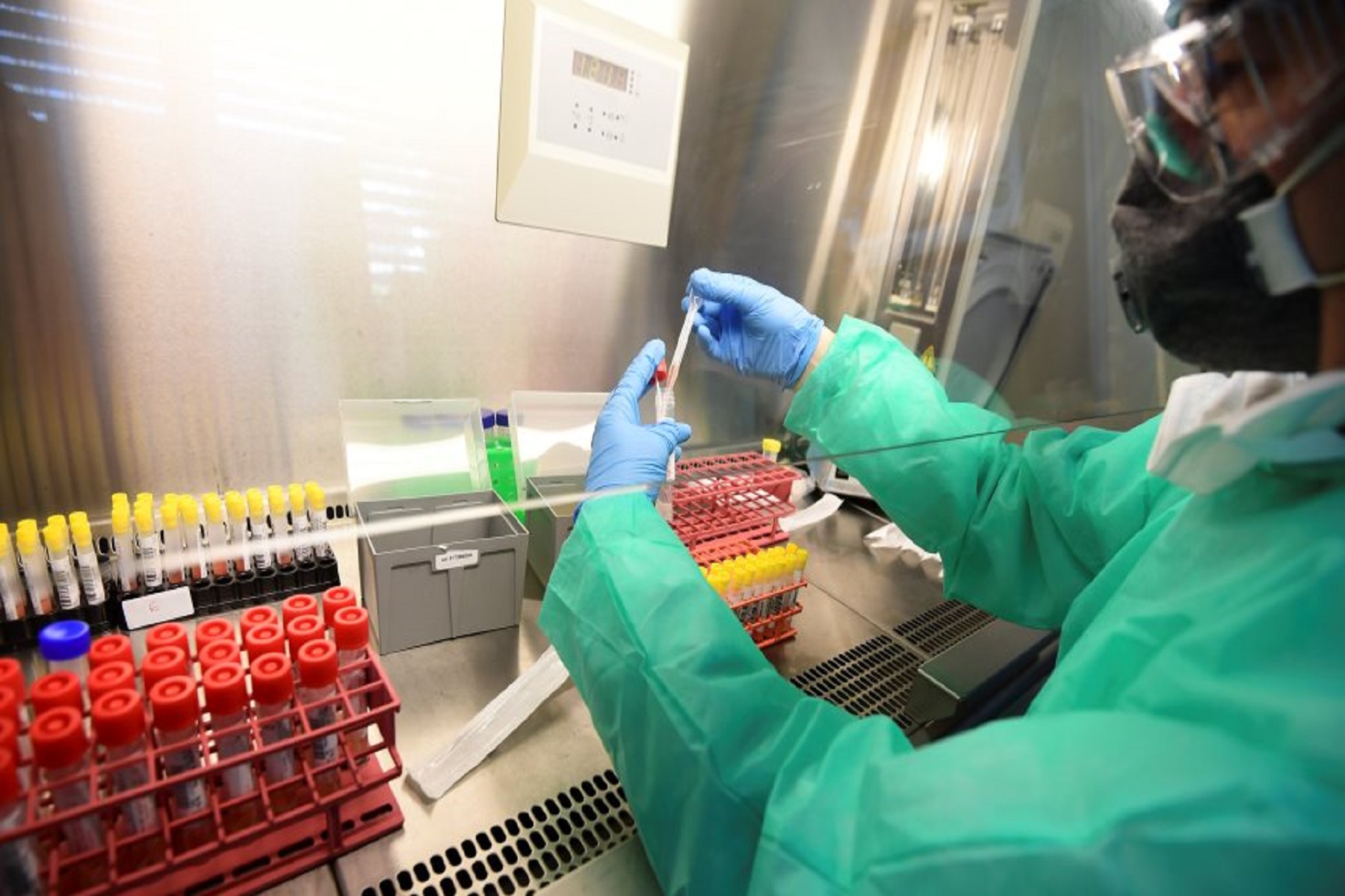 Οξφόρδη Πανεπιστήμιο: Ανοίγει τον δρόμο για βελτιωμένα εμβόλια και θεραπείες με δοκιμές πρόκλησης covid