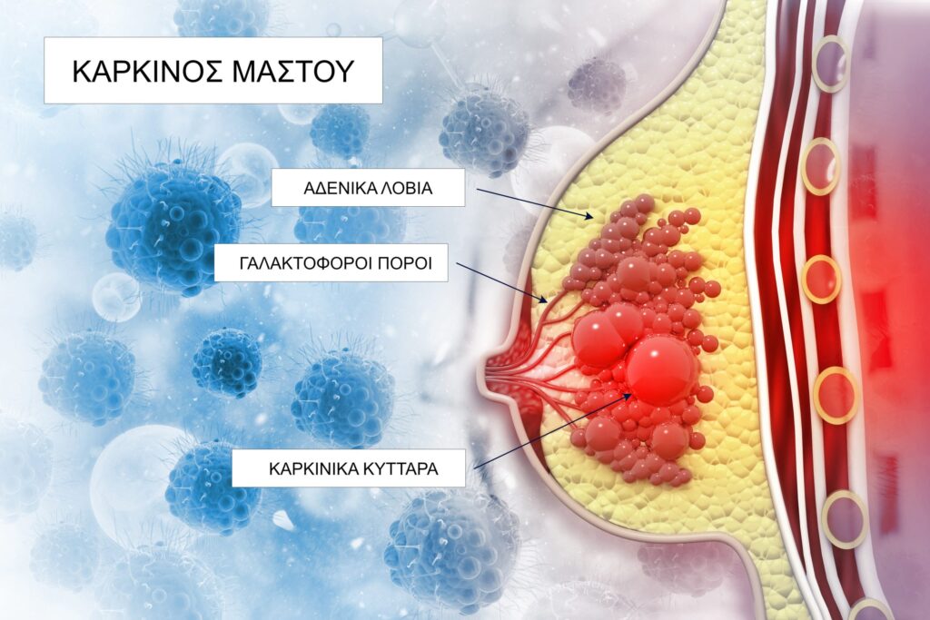 Η αρχιτεκτονική των ιστών ρυθμίζει την εξέλιξη του όγκου