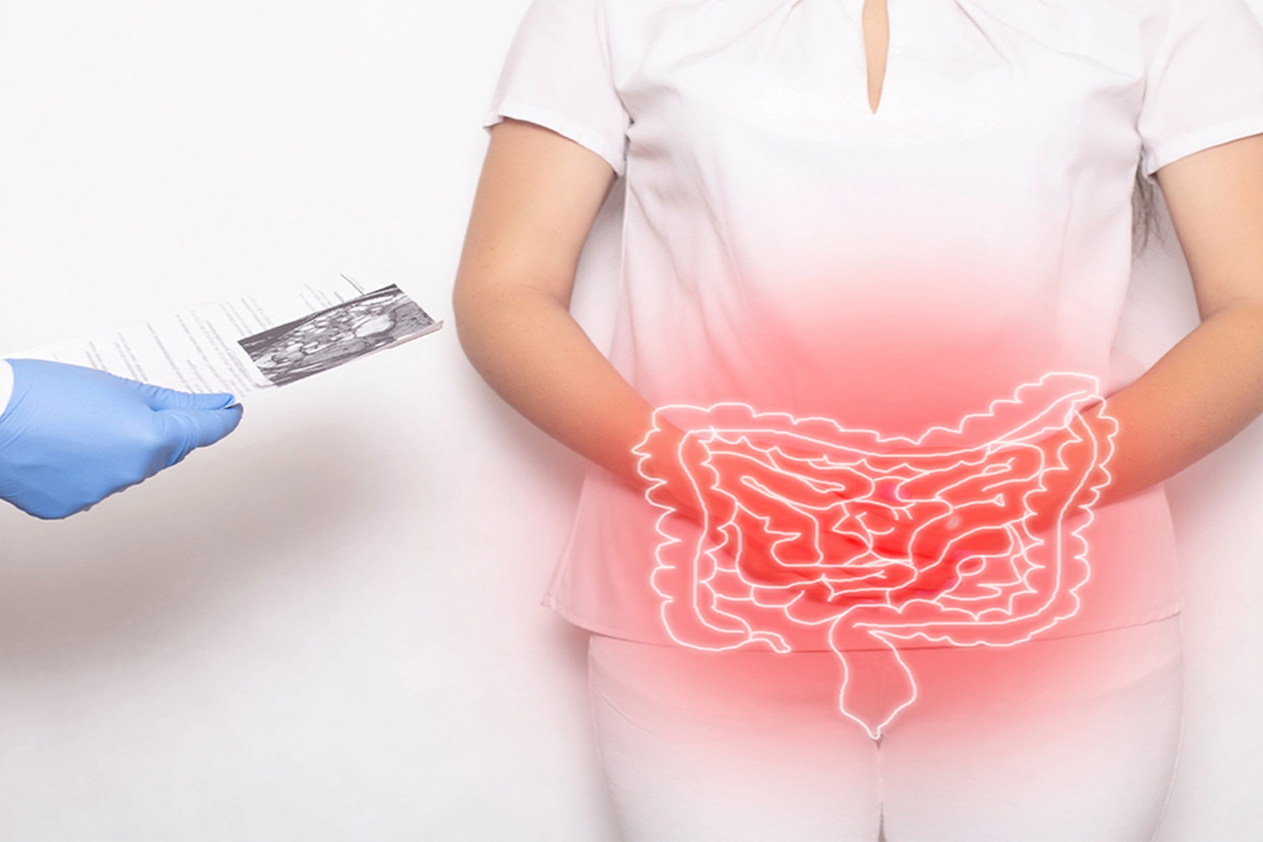 Ελκώδης Κολίτιδα νόσος Crohn : Δεν επιβαρύνουν ασθενείς με covid-19