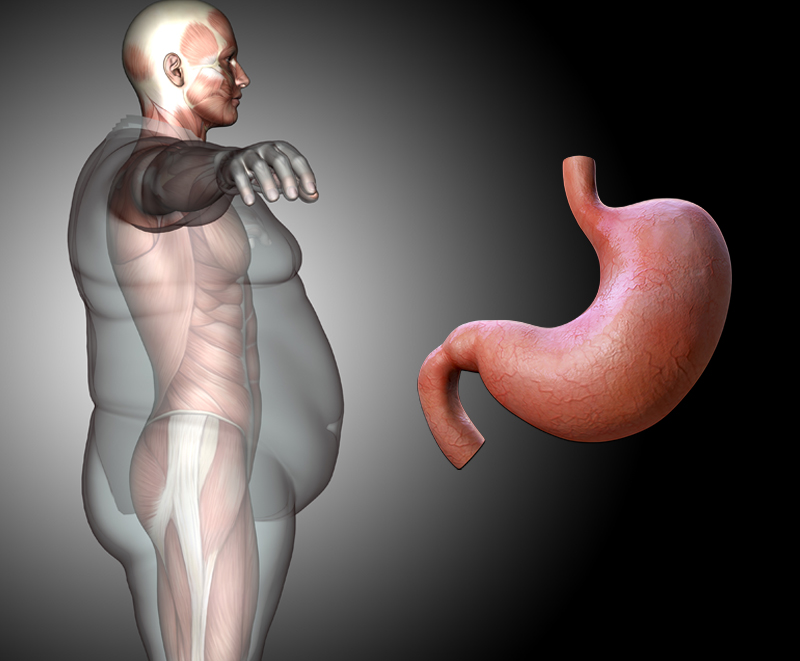 Παχυσαρκία : Πως σχετίζεται με το πεπτικό σύστημα