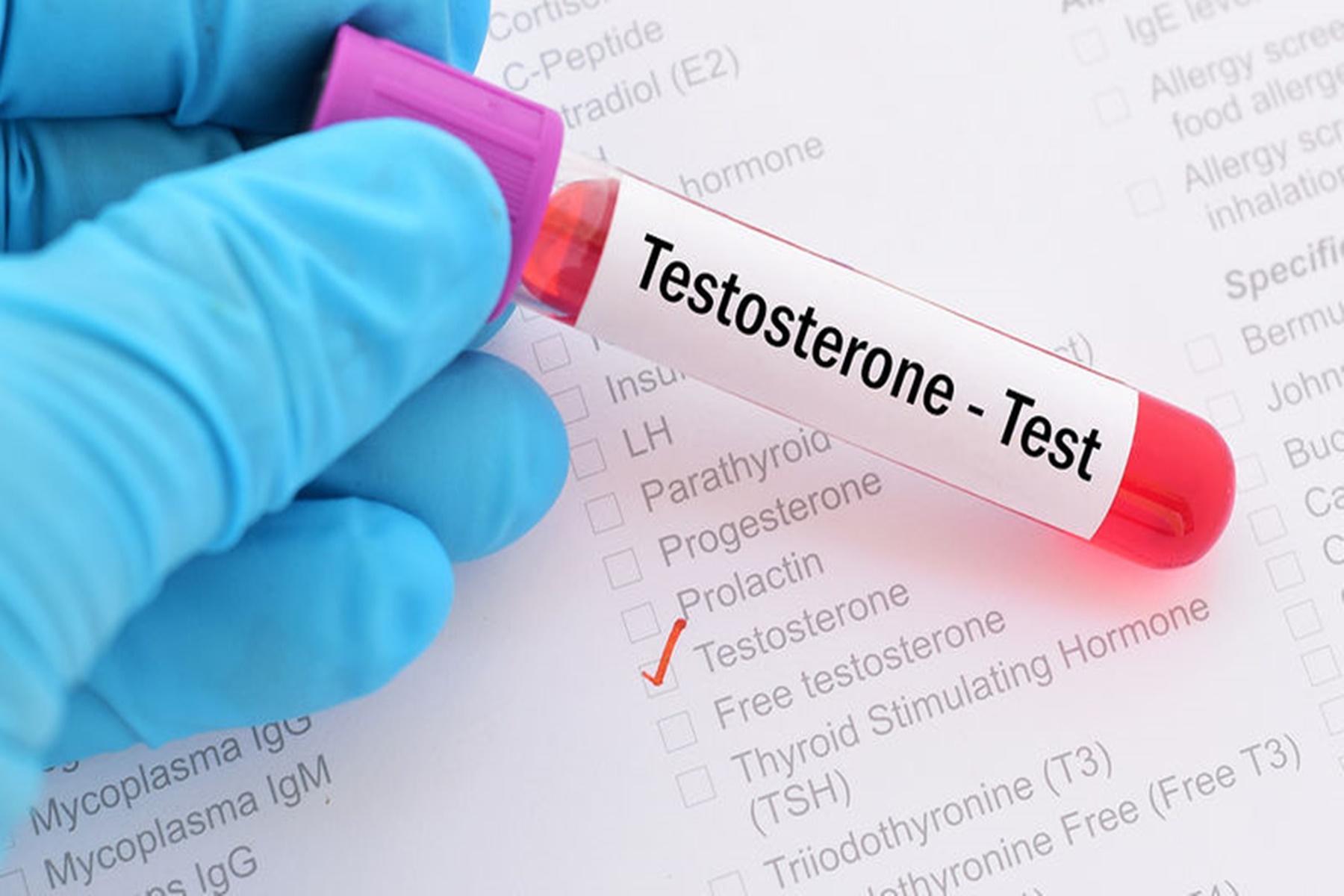 Πανδημία : Πιο ευάλωτοι οι άνδρες με χαμηλή τεστοστερόνη