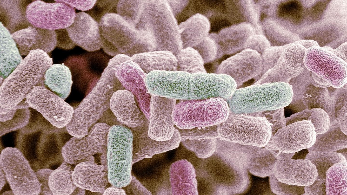 HΠΑ Ουάσιγκτον: H επιδημία e.coli μπορεί να σχετίζεται με φρέσκα προϊόντα