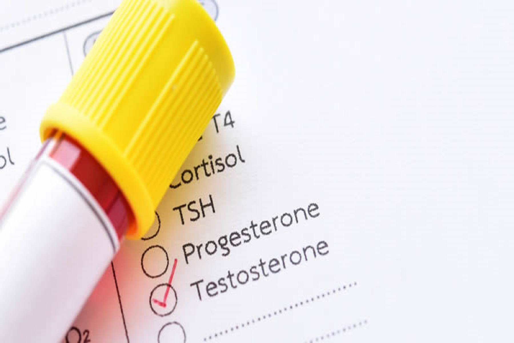 Κορωνοϊός Ορμόνες: Χαμηλή τεστοστερόνη σε άνδρες που συνδέεται με πιο σοβαρή COVID-19