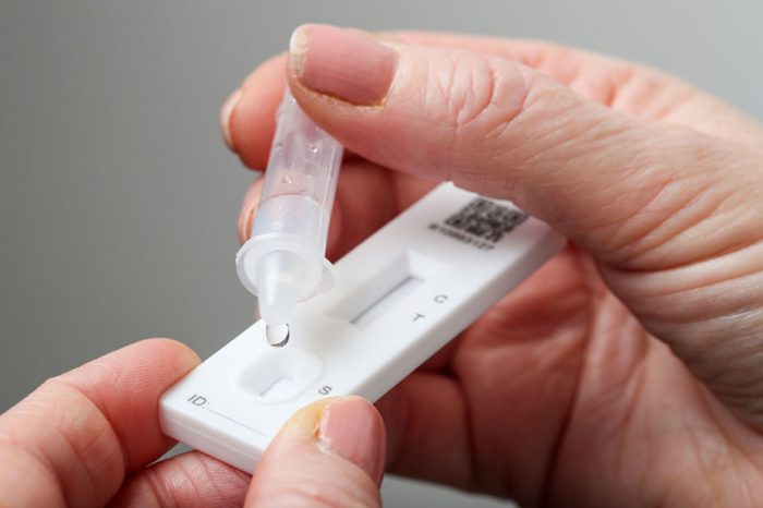 Κορωνοϊός: Τεστ αντιγόνου ανιχνεύουν με ακρίβεια τον SARS-CoV-2 στην πρώιμη φάση συμπτωμάτων της λοίμωξης