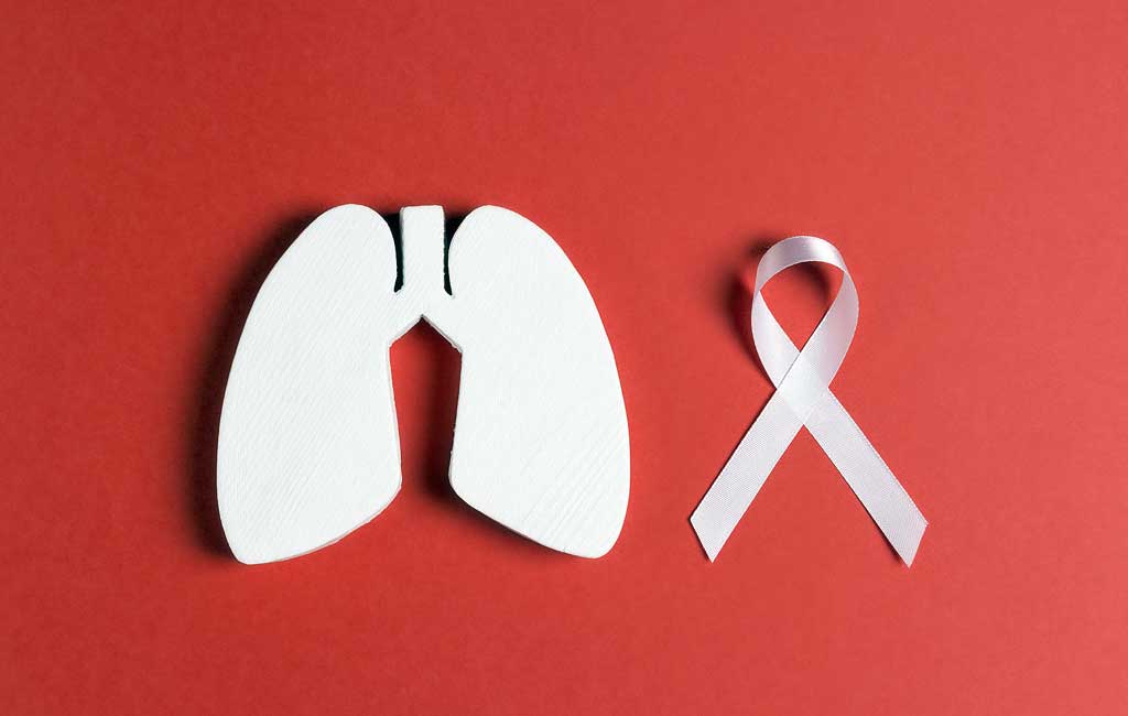 Καρκίνος του Πνεύμονα: Μείωση των θανάτων κατά 25% αν εφαρμοστεί ο Προσυμπτωματικός Έλεγχος