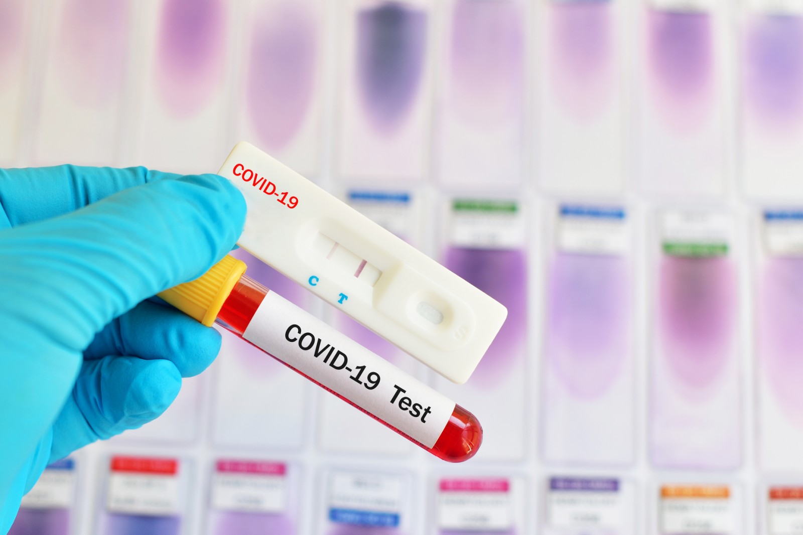 Τιμές τεστ:Ανώτατα όρια τιμών των τεστ PCR test και  Rapid