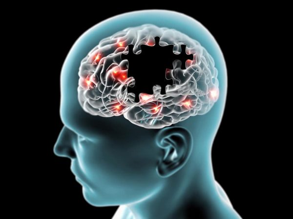 Αλτσχάιμερ: Σημάδια της νόσου μπορούν να ανιχνευθούν πριν γίνουν εμφανή τα συμπτώματα