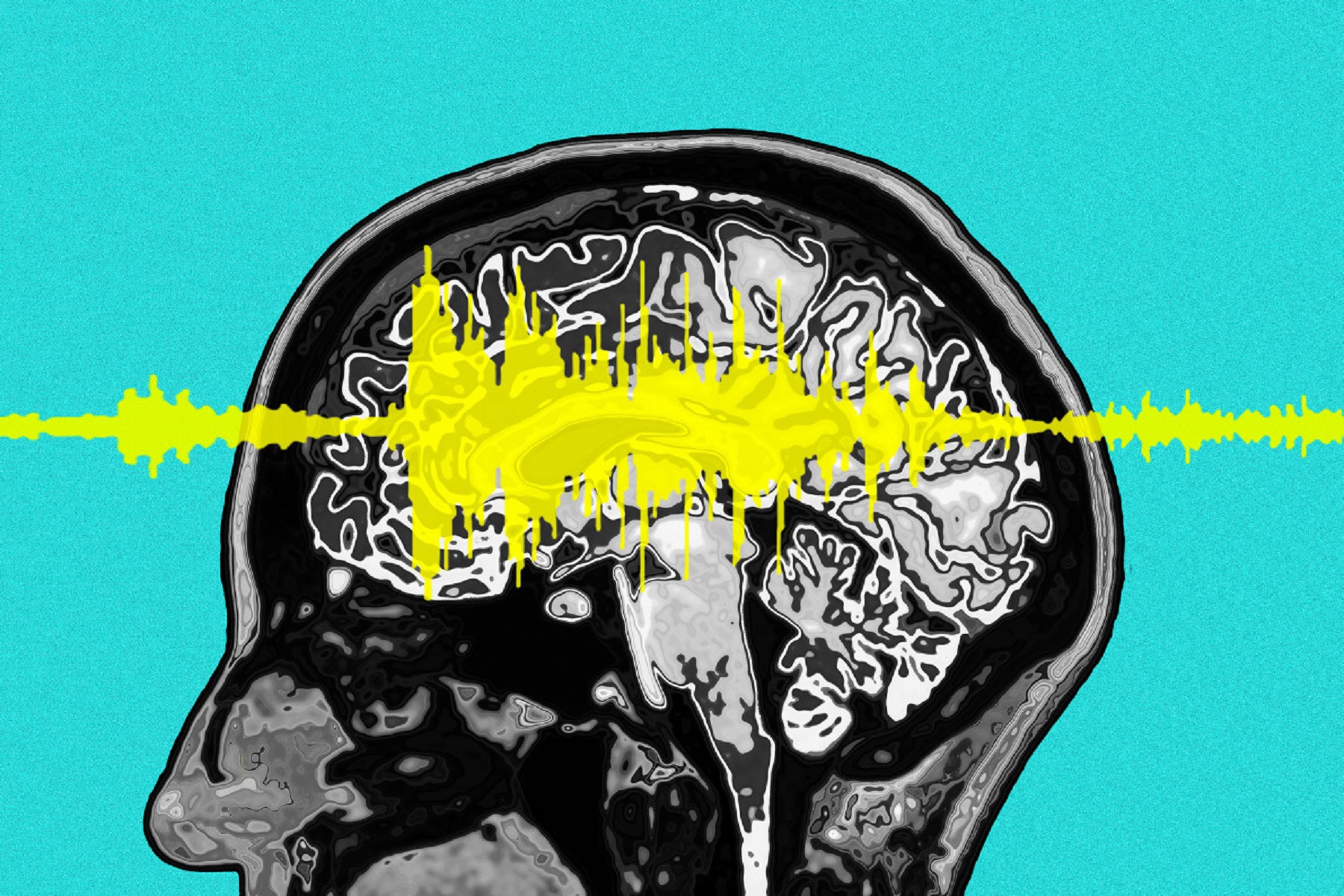 HΠΑ Ερευνητές: «Επιτυχία-ορόσημο στην προσπάθεια εφαρμογής των προόδων της νευροεπιστήμης στη θεραπεία των ψυχιατρικών διαταραχών»
