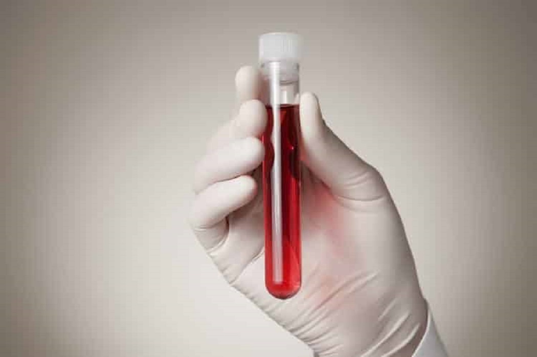 Επιστήμη Καρκίνος: Προσπάθειες ανίχνευσης με τεστ αίματος για βελτίωση των αποτελεσμάτων ασθενών