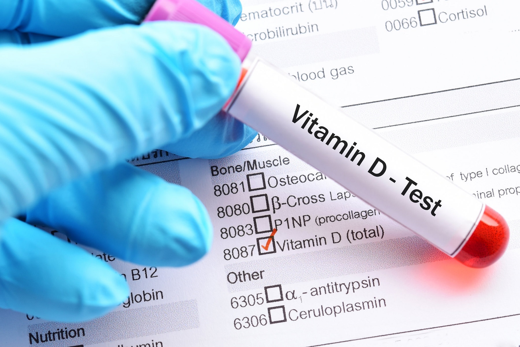 Πανεπιστήμιο Κέιμπριτζ: Η ανεπάρκεια βιταμίνης D συνδέεται τυχαία με τον κίνδυνο θνησιμότητας σε μερικούς ανθρώπους