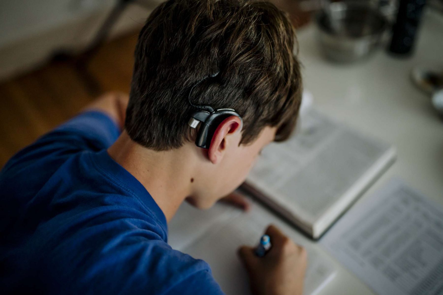 Κοχλιακά εμφυτεύματα: Μελέτη συσχετίζει την παρουσία τους με περαιτέρω απώλεια ακοής μακροπρόθεσμα
