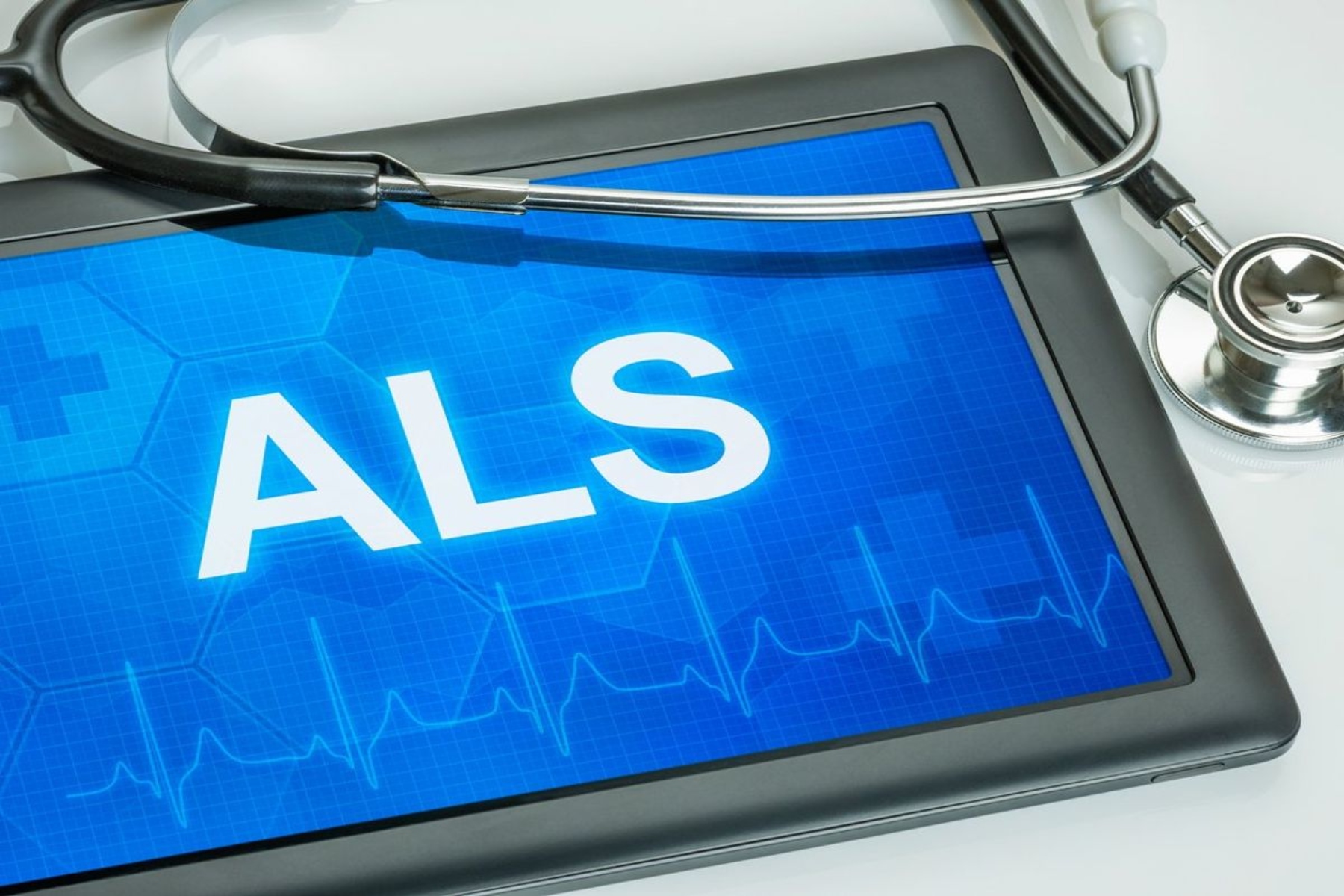 Αμυοτροφική πλευρική σκλήρυνση ALS: Μελέτη ανέδειξε τον εγκέφαλο ως κύρια στόχευση θεραπείας