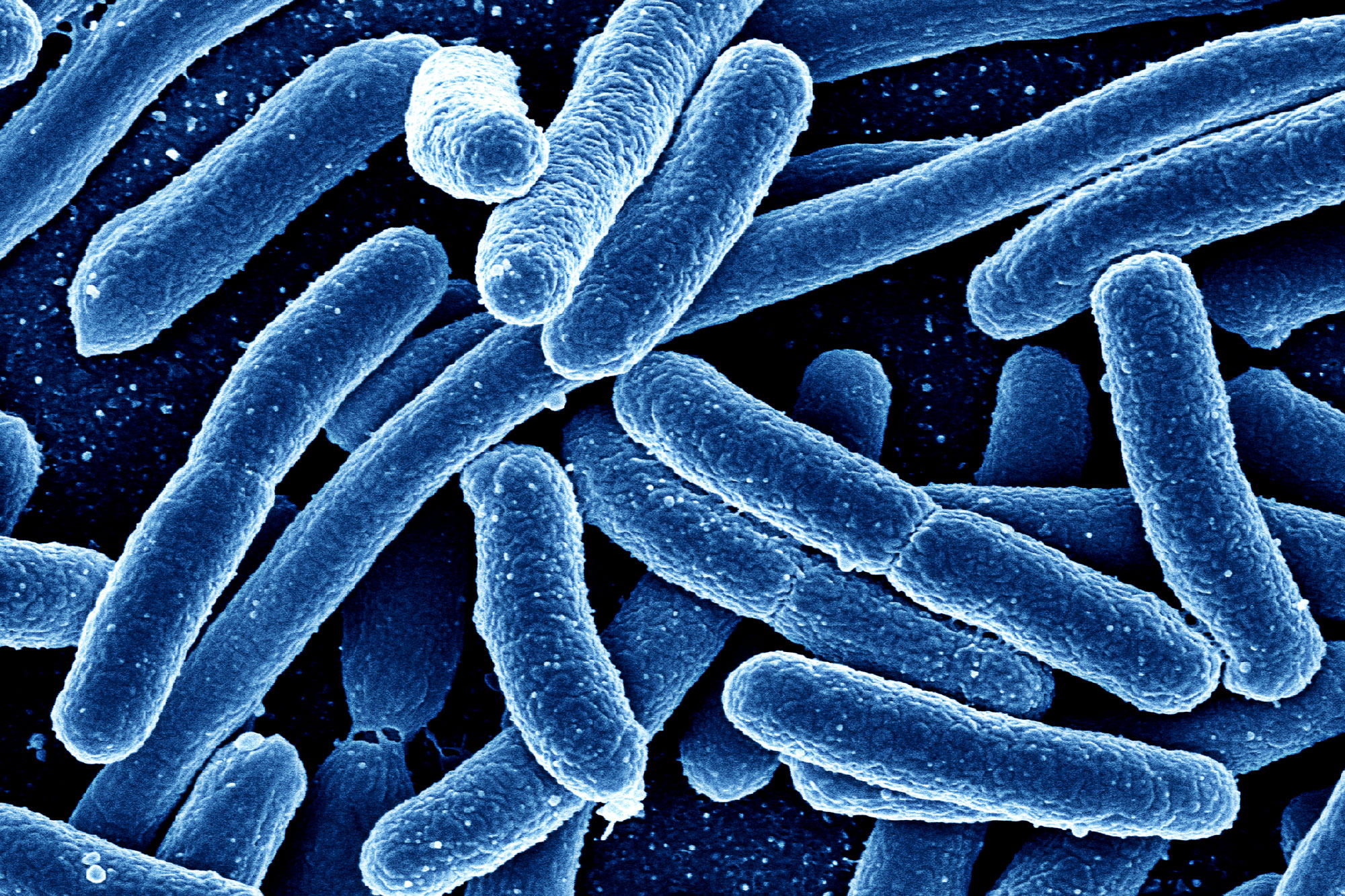Έκθεση ΠΟΥ/ECDC: Η μικροβιακή αντοχή παραμένει απειλή για την υγεία στην Ευρωπαϊκή Περιφέρεια