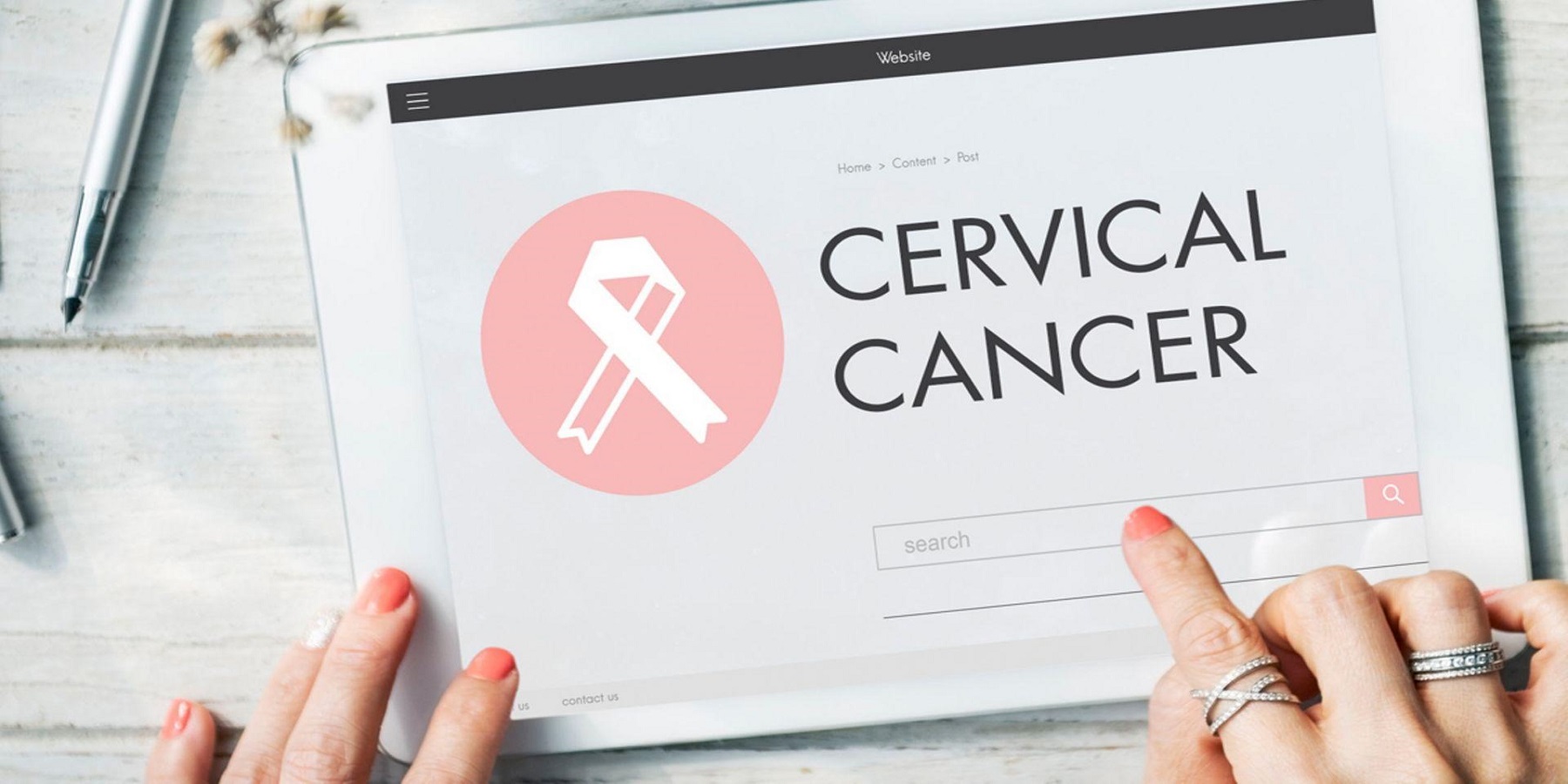 Καρκίνος Tραχήλου της Mήτρας: Ο Ιανουάριος σηματοδοτεί τον μήνα ευαισθητοποίησης