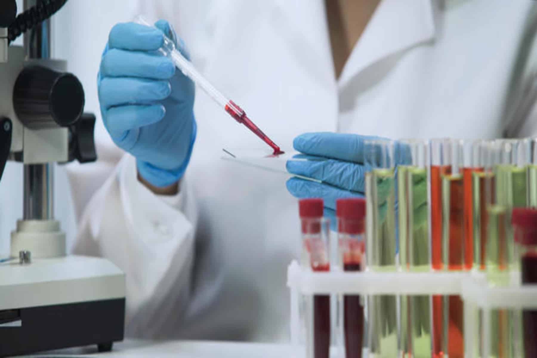 HIV θεραπεία: Η πρώτη γυναίκα θεραπεύεται μετά από μεταμόσχευση βλαστοκυττάρων