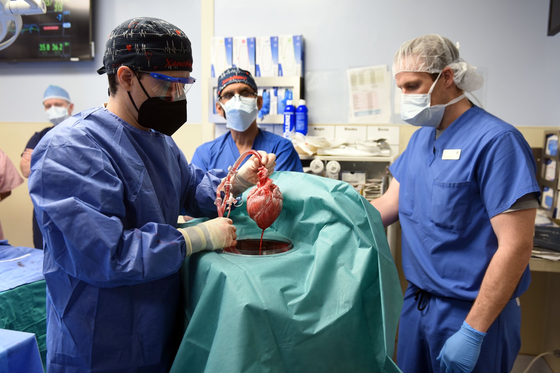 Μεταμόσχευση καρδιάς χοίρου: Πέθανε ο άνδρας που έκανε την 1η μεταμόσχευση καρδιάς χοίρου