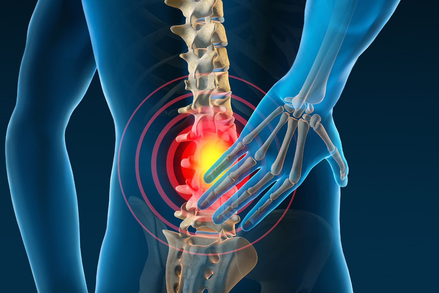 Σπονδυλική στήλη Νεάτερνταλ: Αποκωδικοποιώντας τον συνεχή πόνο στην πλάτη