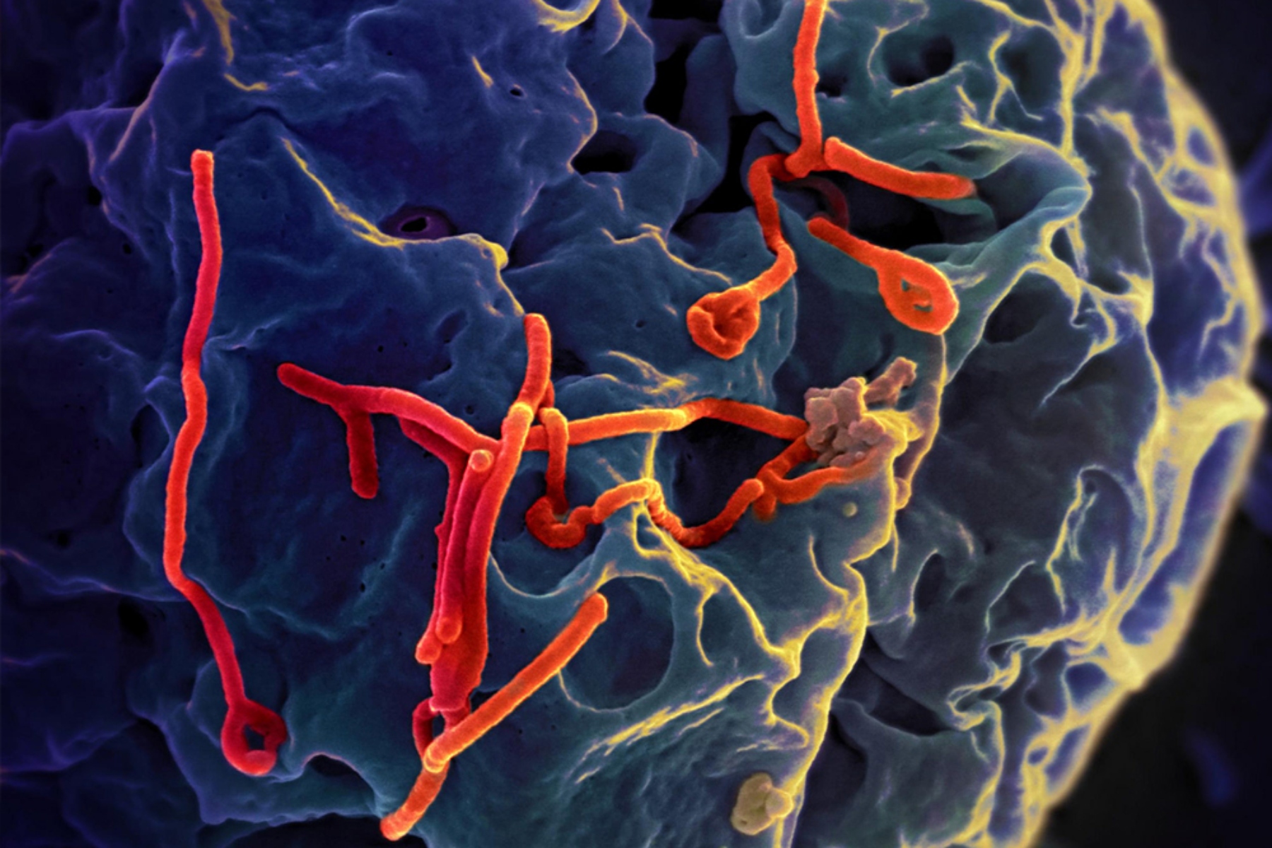 Έμπολα θεραπεία: Η στόχευση ανθρώπινης πρωτεΐνης μπορεί να σταματήσει τον ιό