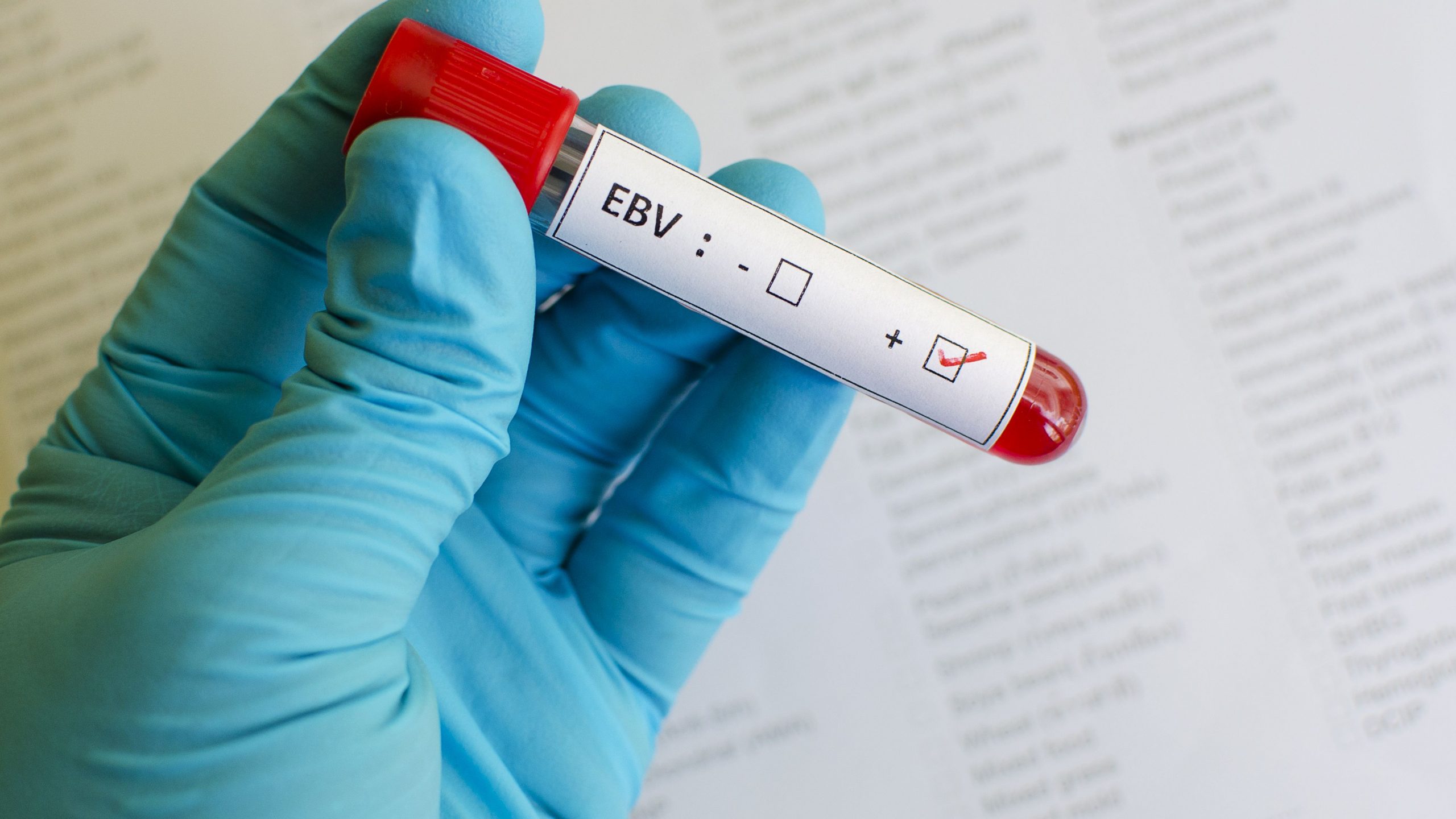 Σκλήρυνση κατά πλάκας: Ο ιός Epstein-Barr είναι υπεύθυνος για τη νόσο, σύμφωνα με νεότερα δεδομένα