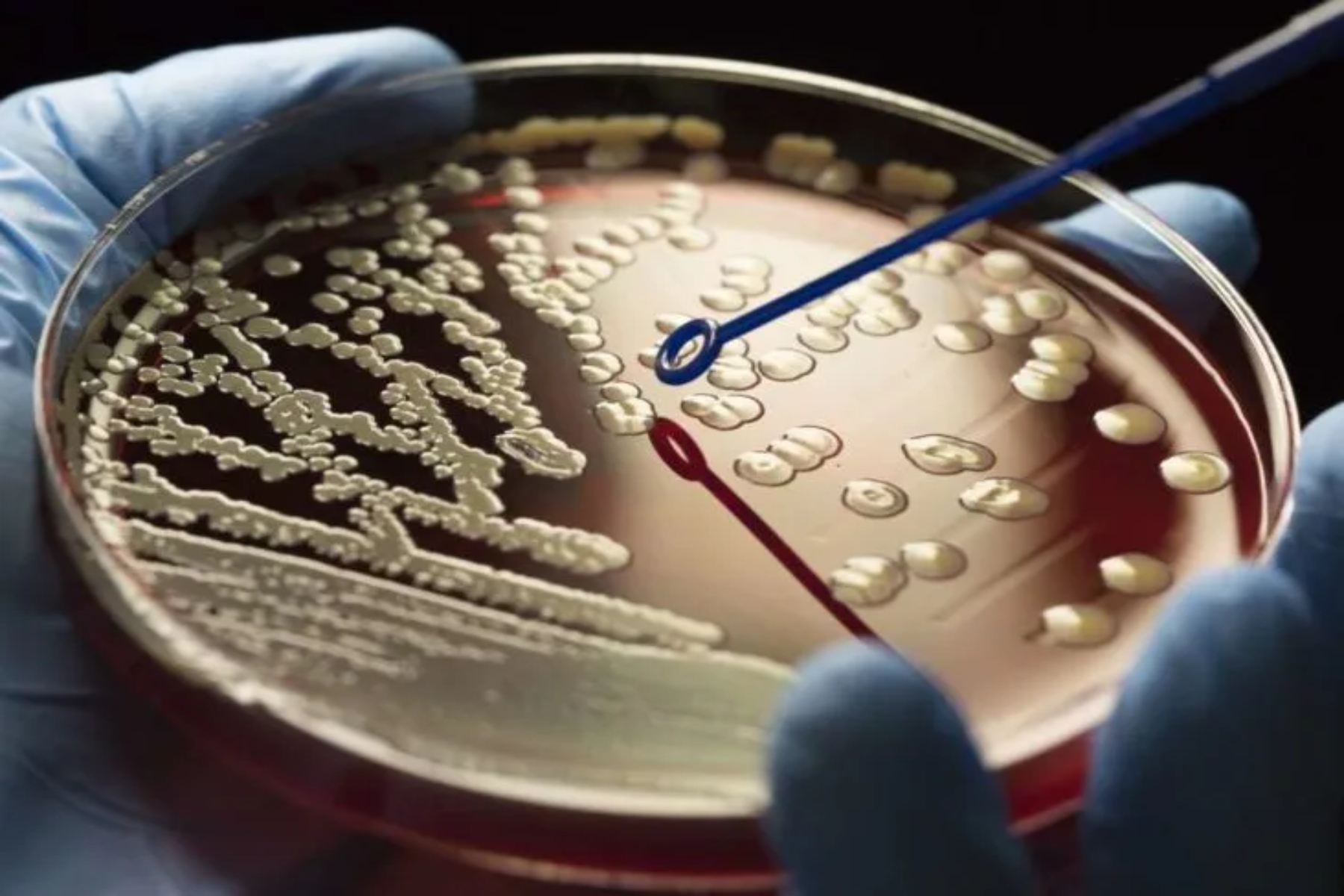 Ανθεκτικότητα Covid: Η πανδημία ενδέχεται να επιταχύνει την μικροβιακή αντοχή