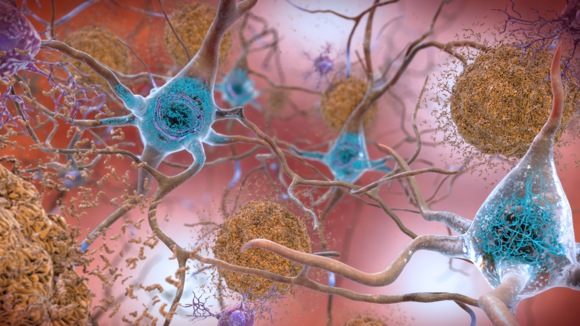 Αλτσχάιμερ: Νέα μελέτη αποκαλύπτει περισσότερες γενετικές μεταλλάξεις στα εγκεφαλικά κύτταρα