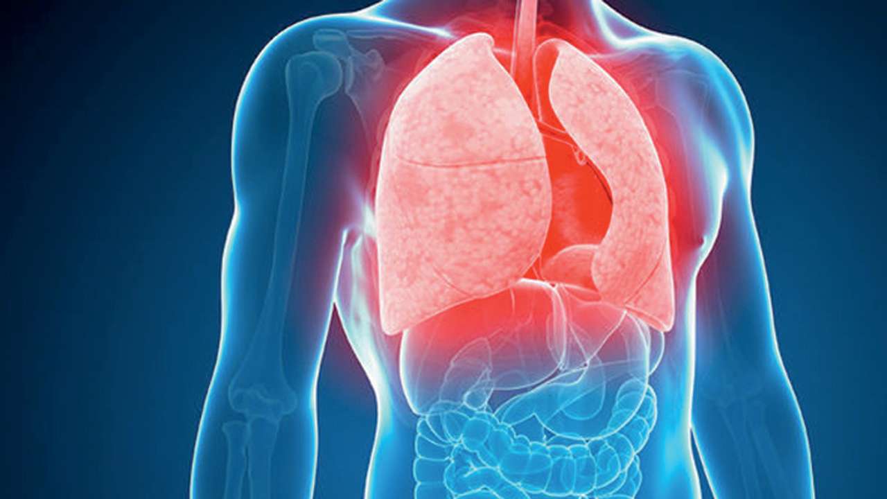 Φυματίωση: Θα μπορούσαν οι θεραπείες καρκίνου να την θεραπεύσουν