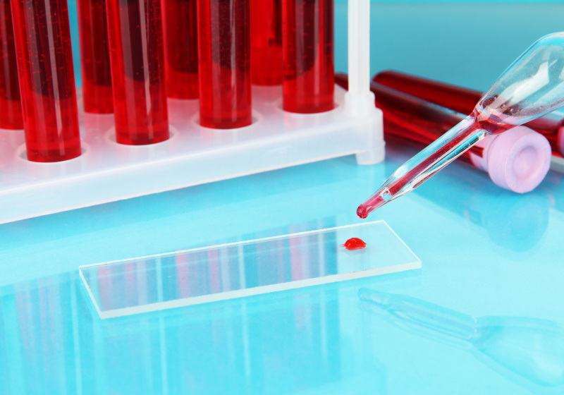 Μικροπλαστικά αίμα: Πώς θέτουν σε κίνδυνο την υγεία