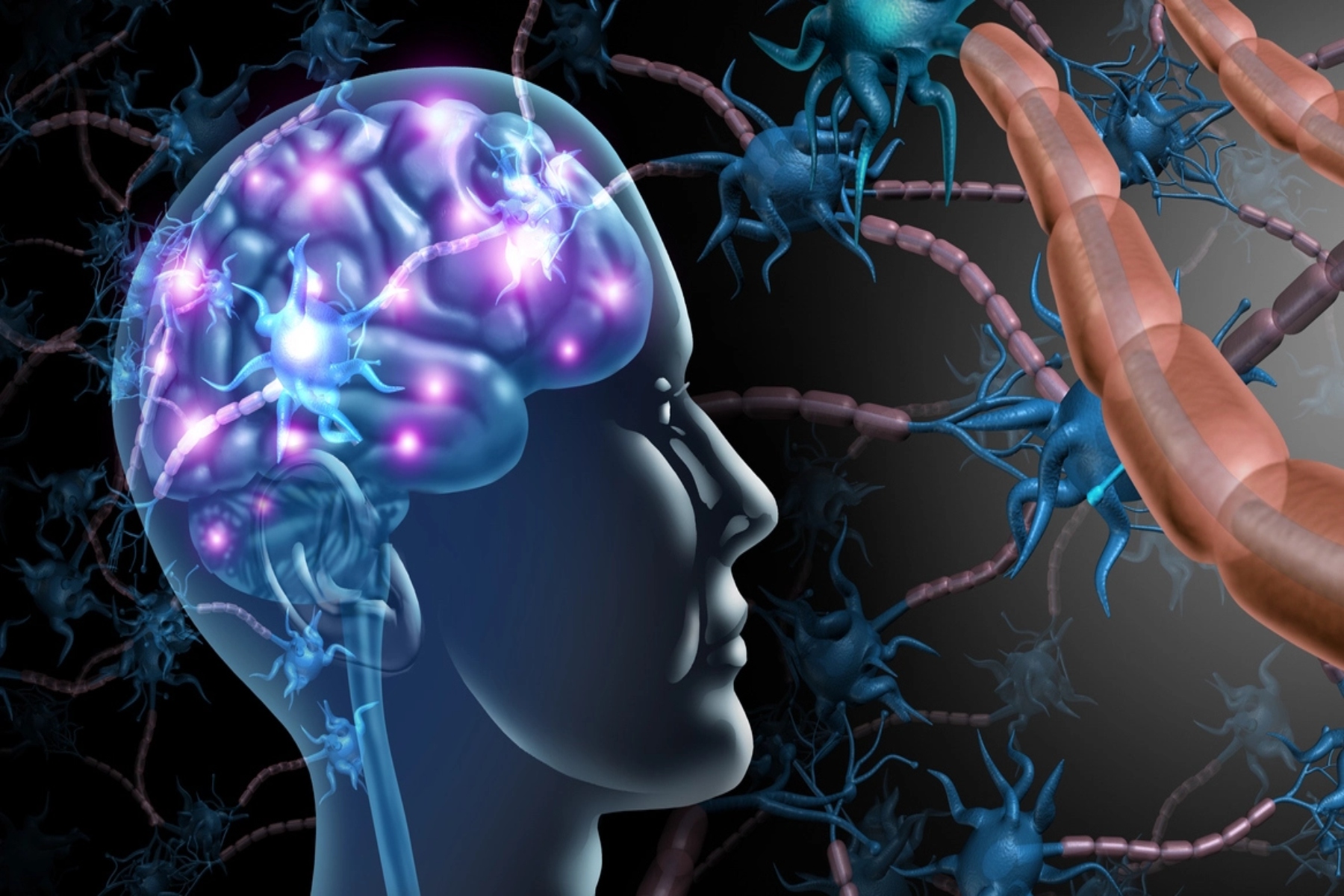 Δυστονία: Βελτιστοποίηση της εν τω βάθει εγκεφαλικής διέγερσης στους νοσούντες