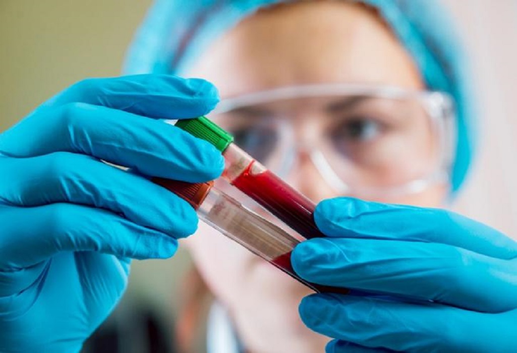 Επιστήμονες ΗΠΑ: Ανάπτυξη νέου τεστ αίματος για την πρόβλεψη εμφράγματος, εγκεφαλικού ή καρδιακής ανεπάρκειας