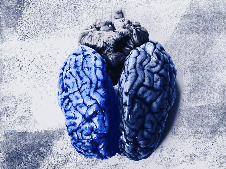 Νόσος Alzheimer: Οι μηχανισμοί του εγκεφάλου πίσω από την απάθεια
