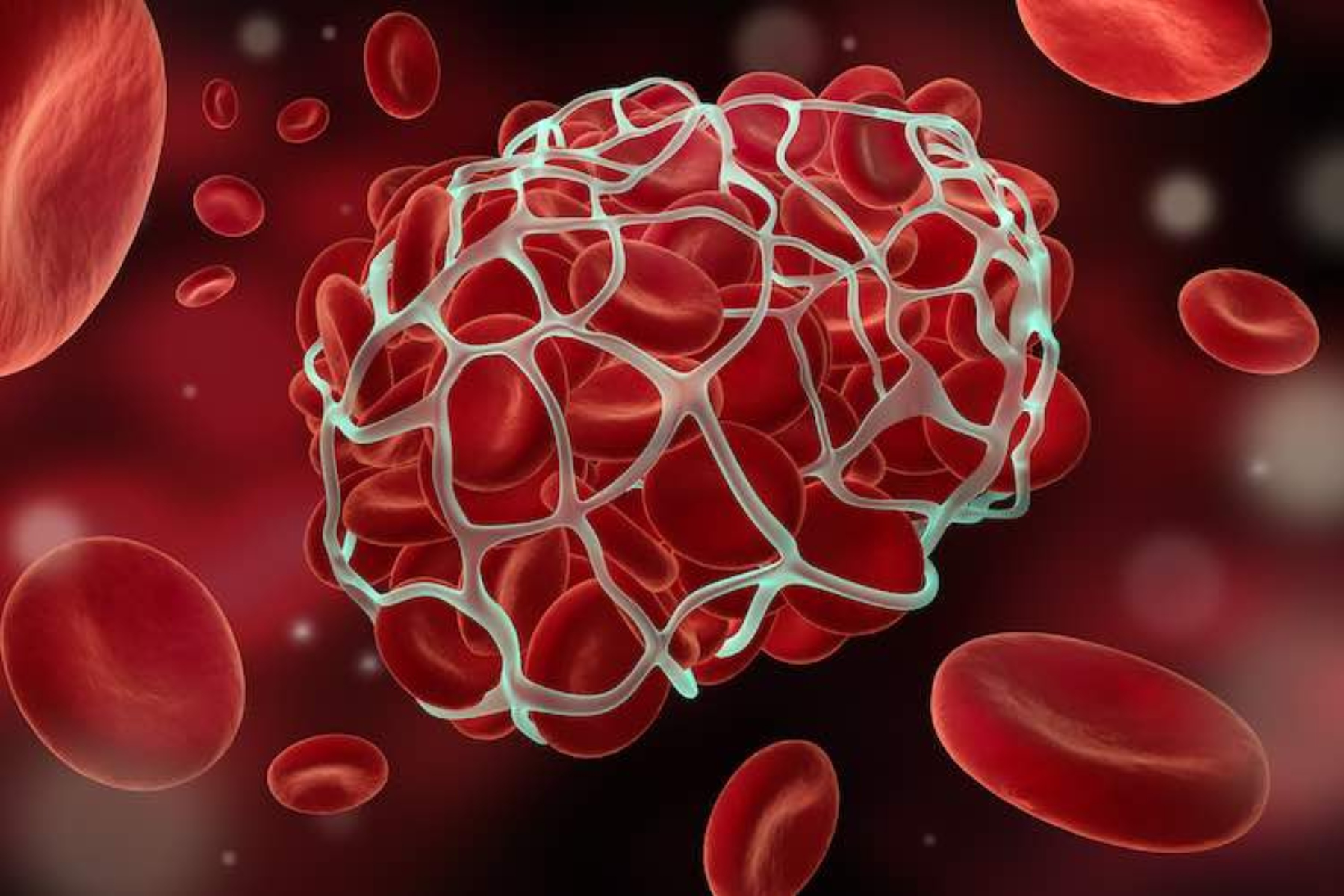 Αίμα θρόμβωση: Η ομάδα αίματος προβλέπει ποιοι καρκινοπαθείς είναι επιρρεπείς σε θρόμβους