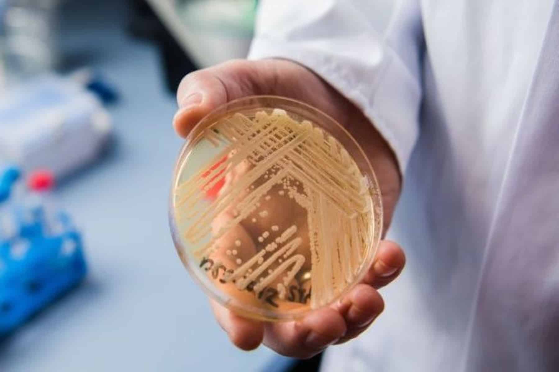 Candida auris: Τι είναι το Candida auris και γιατί συζητούν όλοι γι’ αυτό;