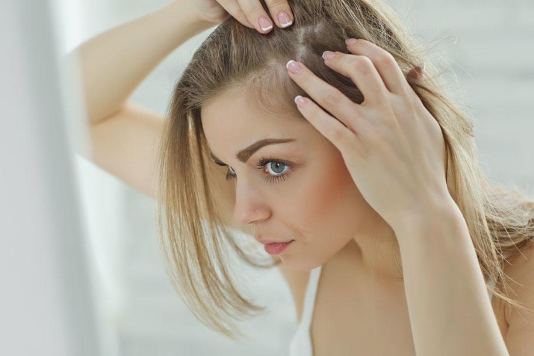 Μαλλιά ακμή: 3 συνήθειες που επιδεινώνουν την ακμή στο τριχωτό της κεφαλής