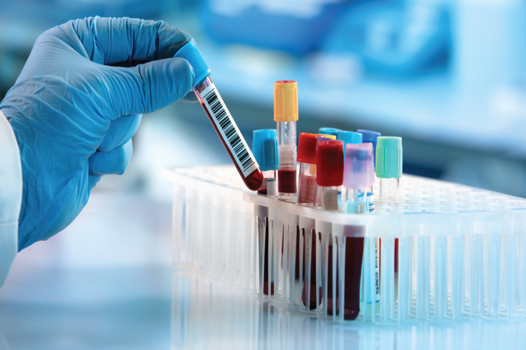 Καρκίνος: Ανακάλυψη τεστ αίματος για τον καρκίνο του ήπατος