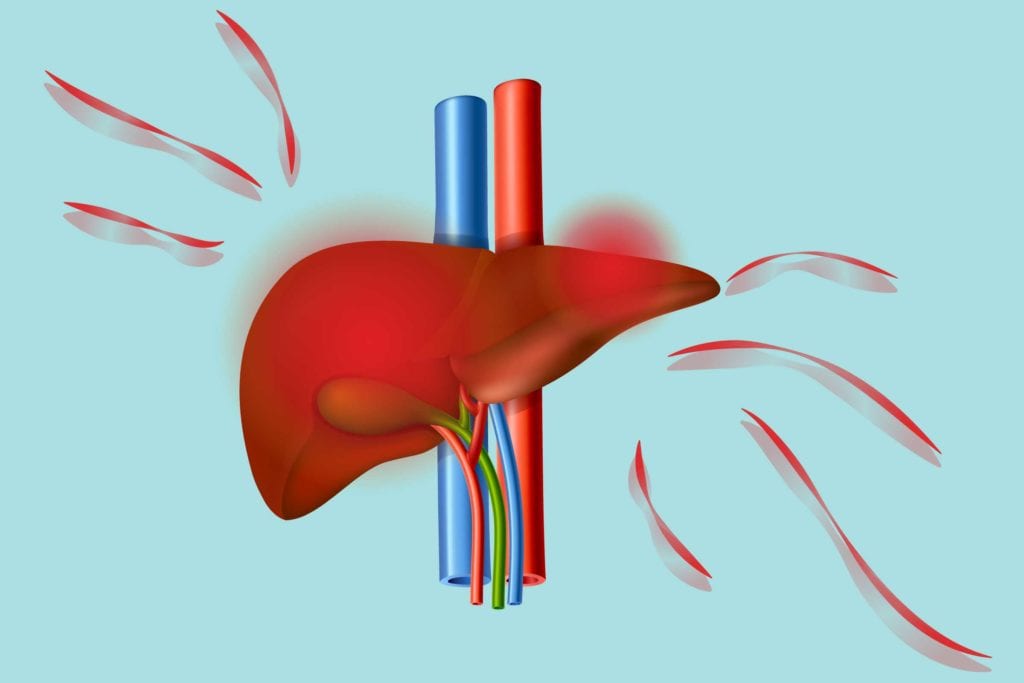 Μη αλκοολική λιπώδης νόσος του ήπατος: Το λίπος στο ήπαρ αυξάνει τον κίνδυνο καρδιακής ανεπάρκειας