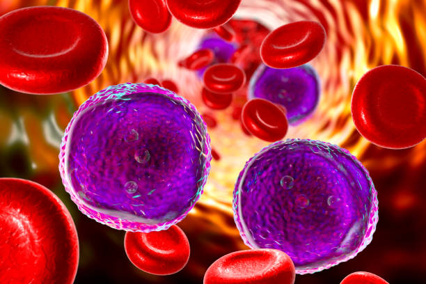 Λευχαιμία: Εξέταση αίματος προβλέπει τον κίνδυνο λευχαιμίας, σύμφωνα με μελέτη