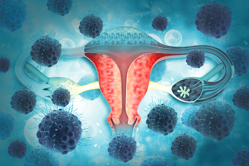 Καρκίνος ωοθηκών omentum: Βασικός ο ρόλος ενός μεταβολικού ενζύμου στη μετάσταση του όγκου