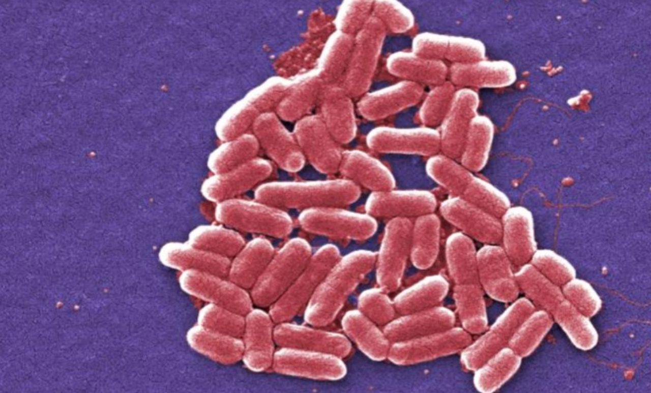 CDC: Ερευνά την επιδημία του E. coli στο Μίσιγκαν και το Οχάιο που έχει μολύνει σχεδόν 30 άτομα