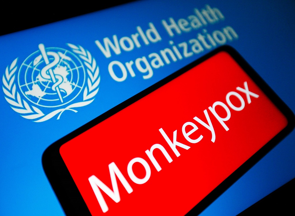 Monkeypox στην Αμερική: Ποιος κινδυνεύει και γιατί