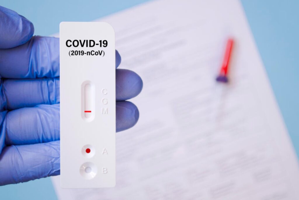 Τα σημεία δωρεάν ελέγχου Covid-19 σήμερα 01/09