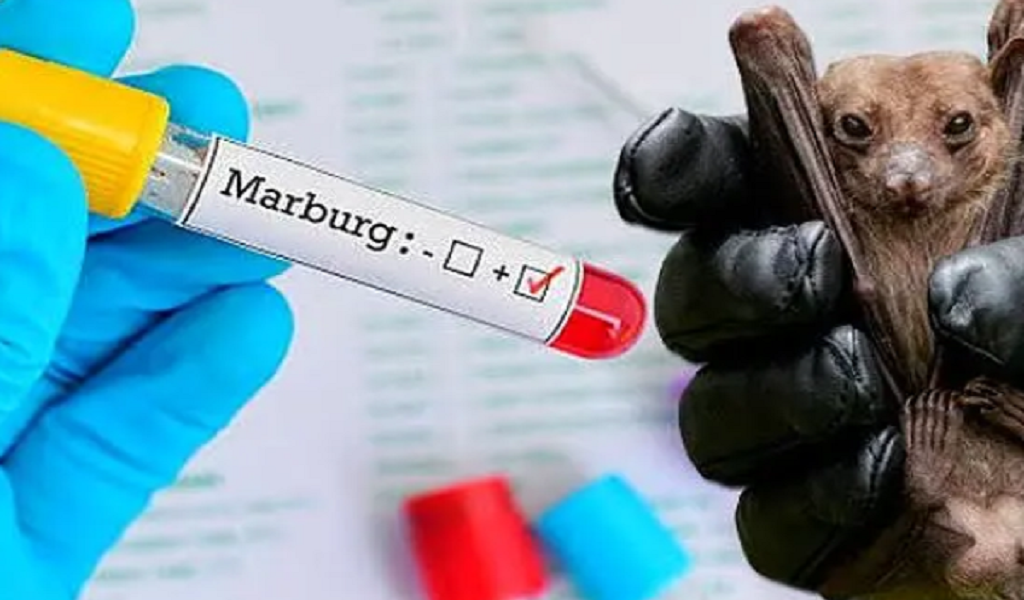 Η Γκάνα κηρύσσει το τέλος της επιδημίας του ιού Μάρμπουργκ