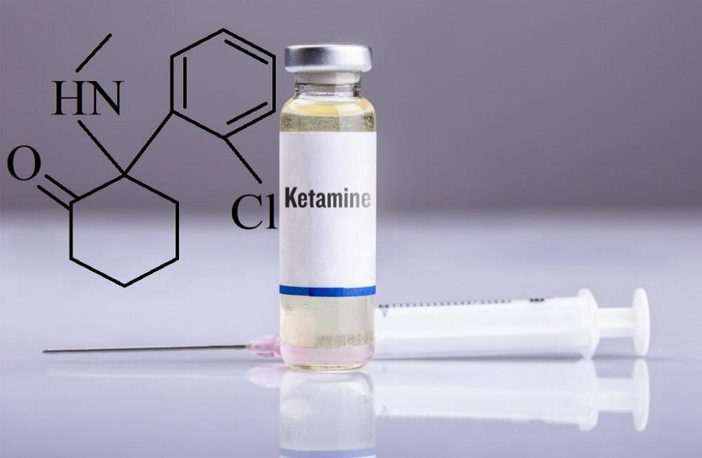 Kεταμίνη: Υπόσχεται πολλά για άτομα ανθεκτικά στη θεραπεία για την κατάθλιψη