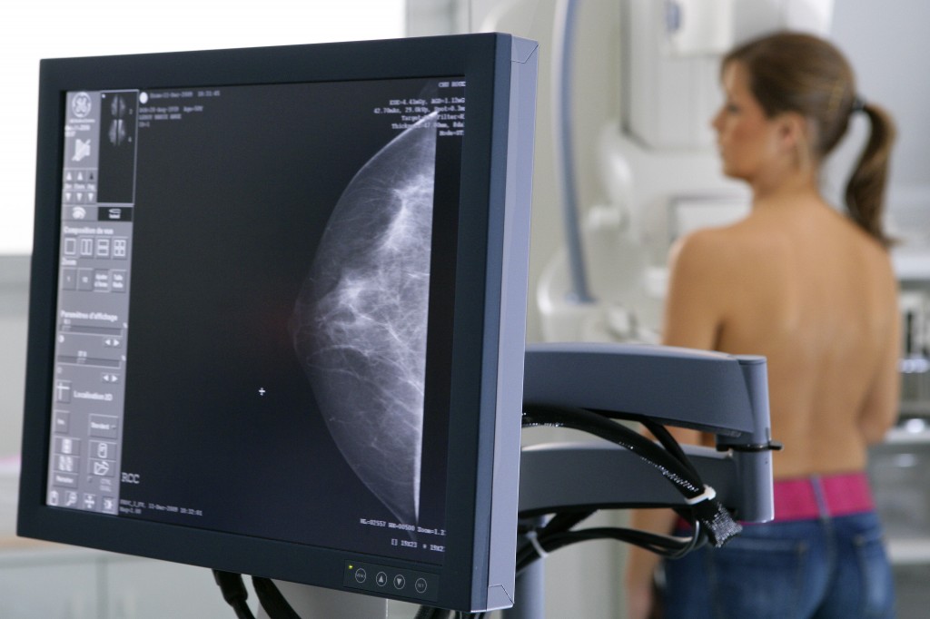 Καρκίνος του μαστού και μαστογραφίες: 3 βασικές ερωτήσεις που πρέπει να κάνουν οι γυναίκες πριν από τις εξετάσεις τους